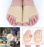 Big Toe Bunion Corrector