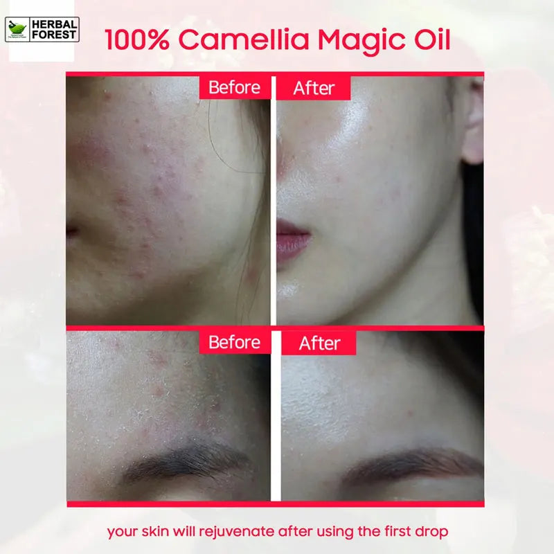 Natural Camellia Oil China Rich in Vitamins Antioxidant Increases Skin Elasticity Removes Wrinkles Increases Hair Shine Body Oil HALALZEN