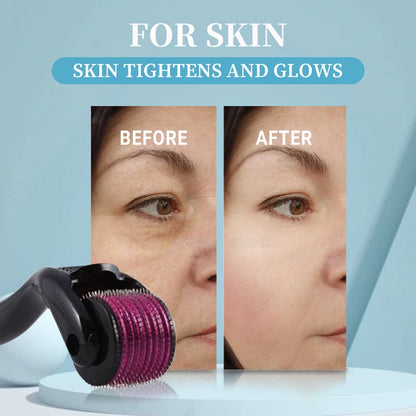 Micro needling Derma Roller