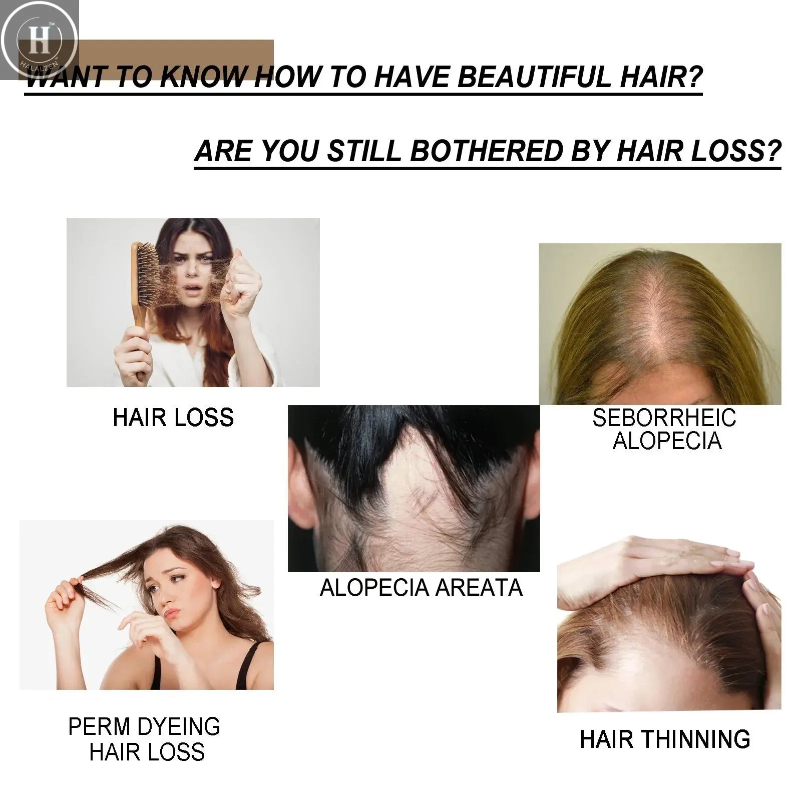 Rice Shampoo Bar Promote Hair Growth Anti Hair Loss Strengthen Hair Roots Scalp Care Dandruff Treatment Volumizing Shampoo Soap HALALZEN