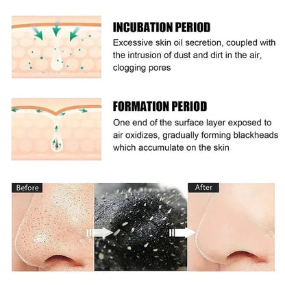Blackhead Remover Nose Strips