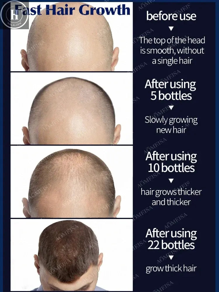 Grow cool hair secretly and surprise everyone. Say goodbye to baldness and hair loss now HALALZEN