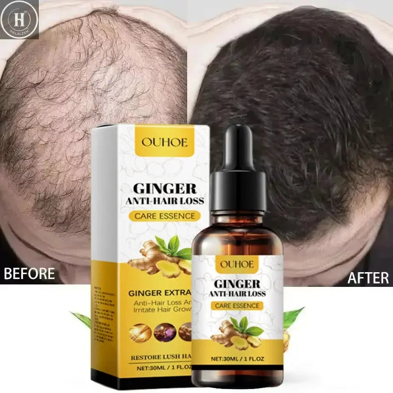 Ginger Hair Growth Essential Oil Anti-loss Hair Treatment Hair Regrowth Oil Fast Hair Promoting Regeneration Hair Care Women Men HALALZEN