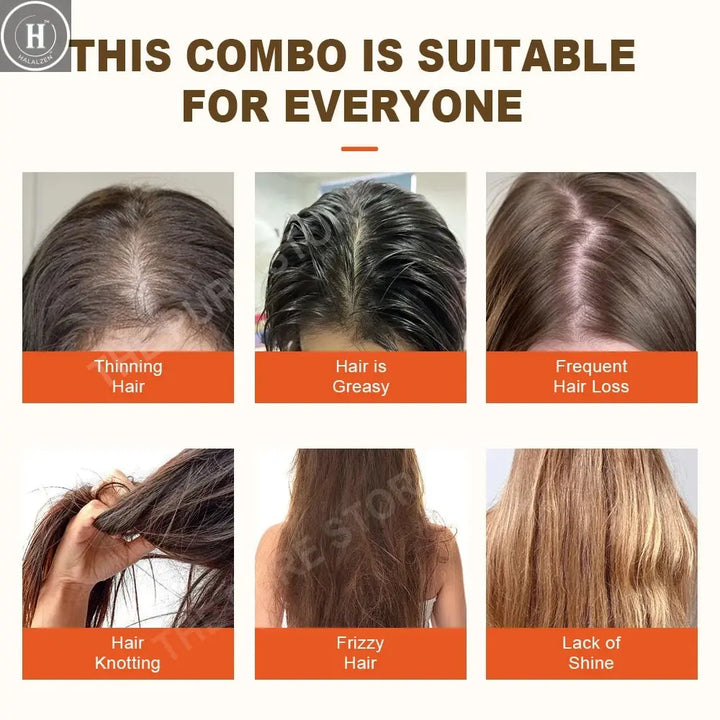 PURC Ginger Shampoo Hair Loss Treatments Nourish Smoothing Thickening Scalp Hair Care Products 600ml HALALZEN