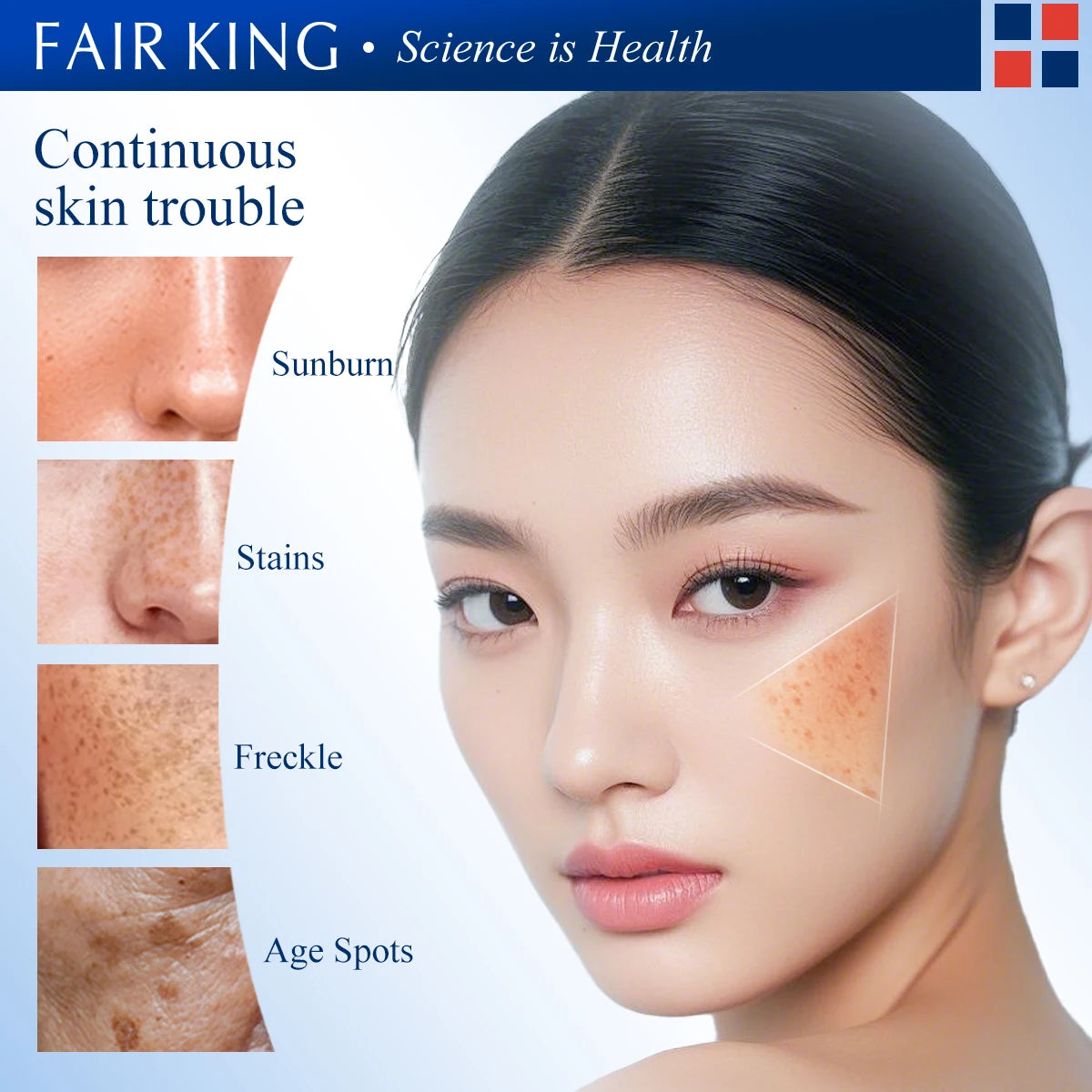 FAIRKING Spot Cream Remove Chloasma Eliminate Dark Spots Brighten Skin Tone Face Skin Care Products Improves Dull Skin