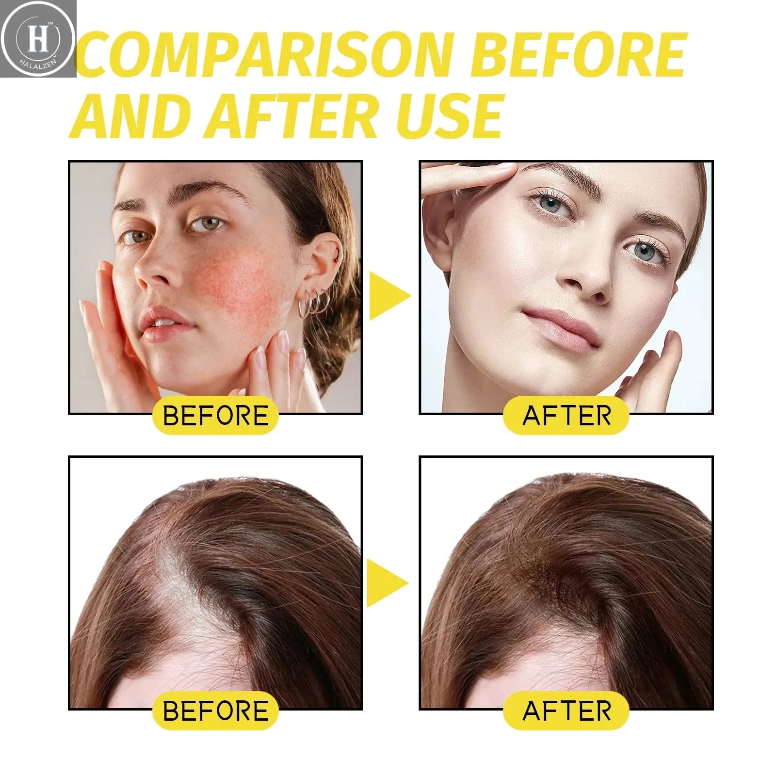 Hair growth essential oil. Effectively repair baldness and hair loss symptoms HALALZEN