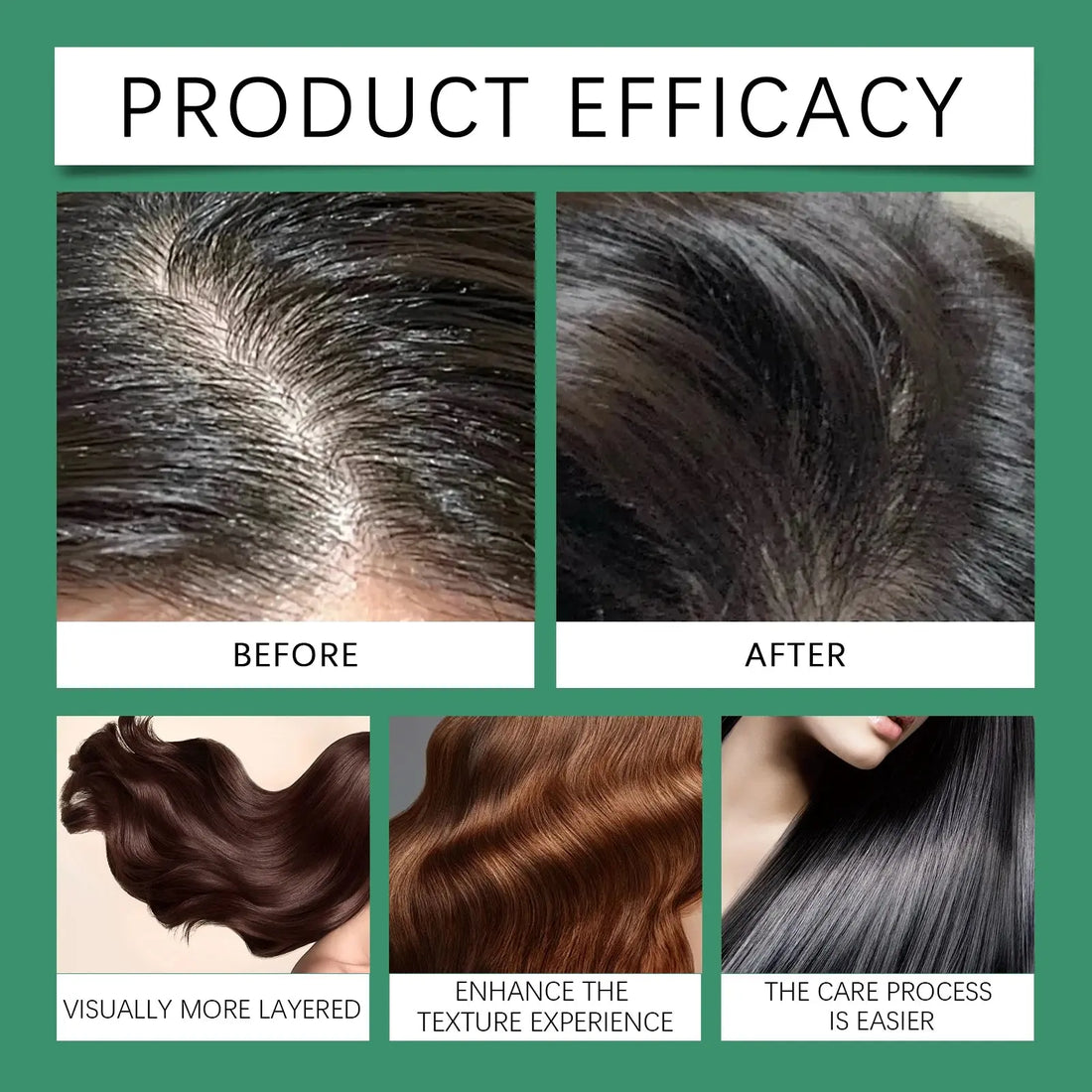 7 Days Fast Ginger Hair Growth Serum Prevent Hair Loss Scalp Treatment Thicker Longer Hair for Accelerate Growth Massage Hair HALALZEN