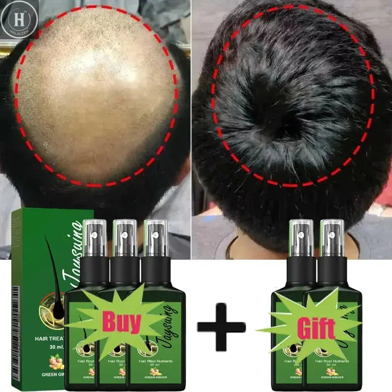 Fast Hair Growth Serum Spray Anti Hair Loss Prevent Baldness Scalp Treatment Repair Roots Beauty Health Hair Care For Men Women HALALZEN