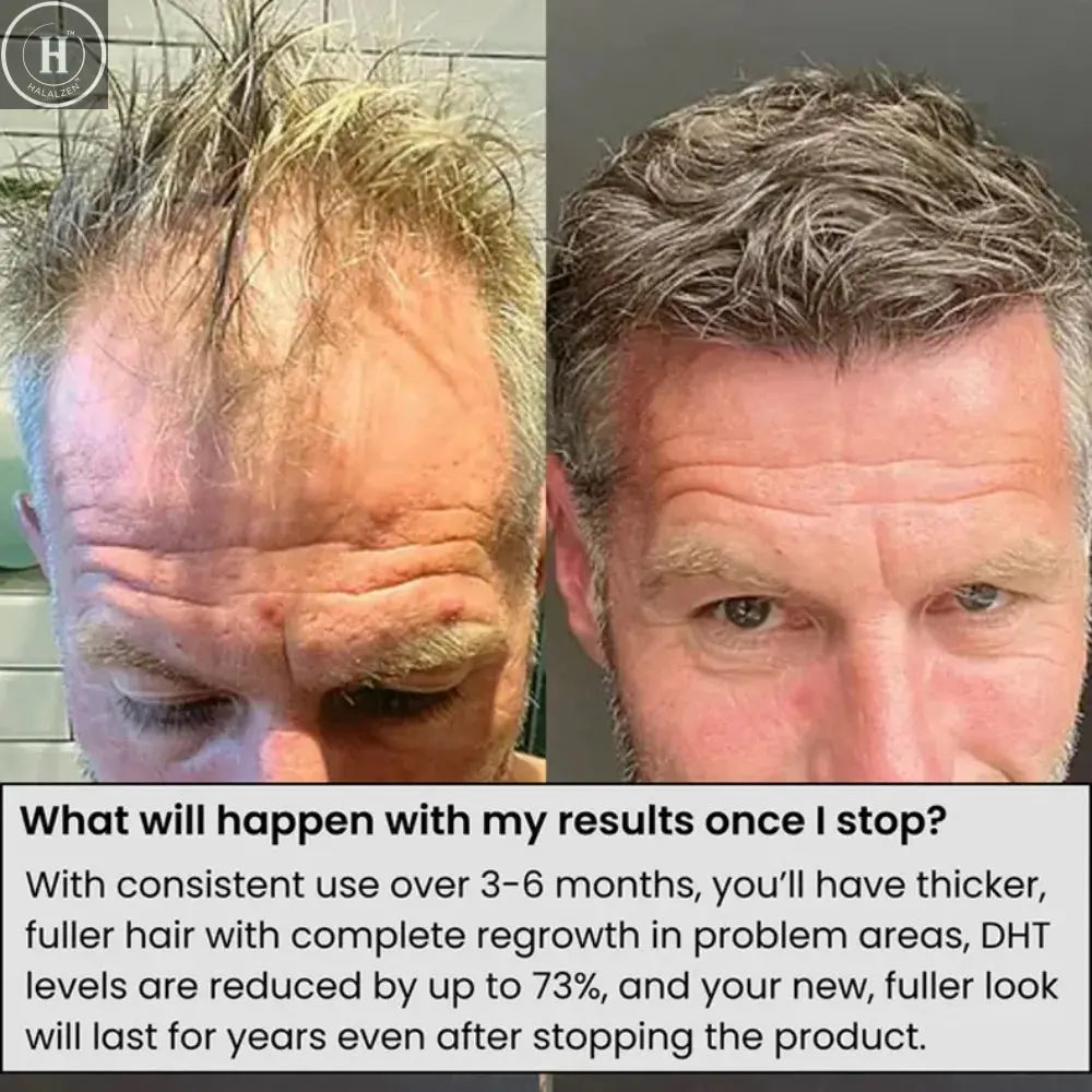 Hair Roller Serum Gentle nourishes the scalp and cares for the softening hair care Daily Care Scalp Serum HALALZEN