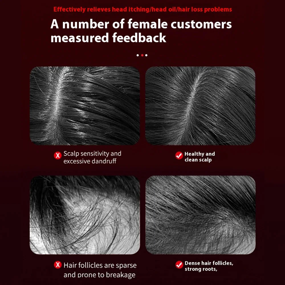 3 Modes Electric Vibration Massage Comb Red Light Therapy Hair Growth Scalp Brush Anti Hair Loss With Liquid Oil Applicator