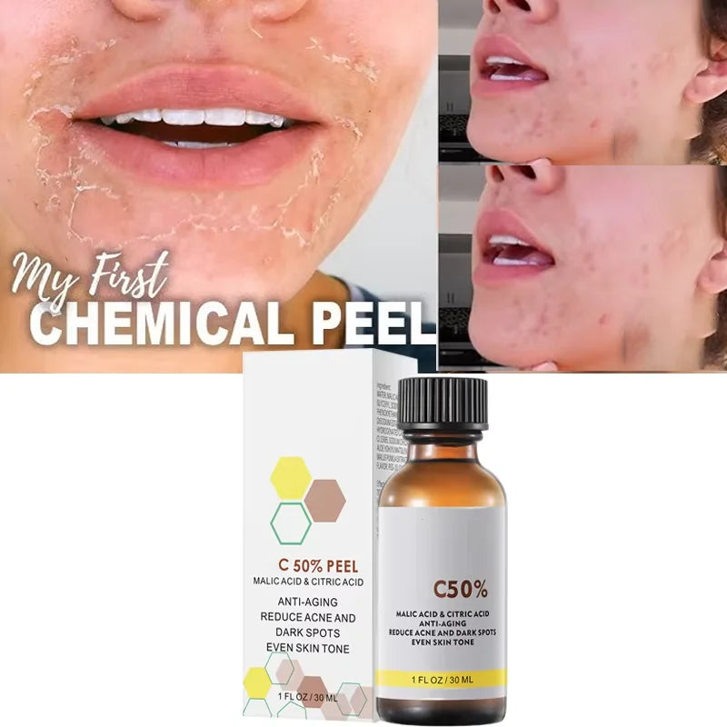 With Malic Acid And Citric Acid For Face Facial Peel 40% Peeling Serum Peeling Serum Chemical Peel Whitening Nourishing Essence HALALZEN