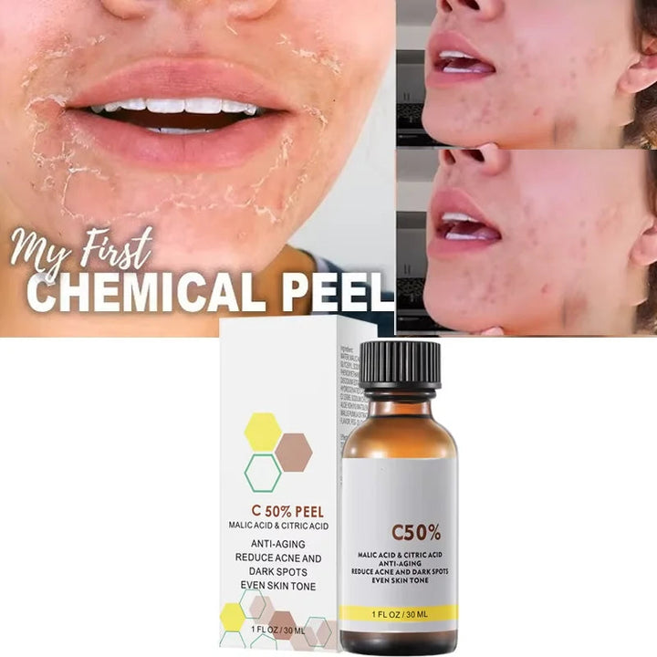 With Malic Acid And Citric Acid For Face Facial Peel 40% Peeling Serum Peeling Serum Chemical Peel Whitening Nourishing Essence HALALZEN