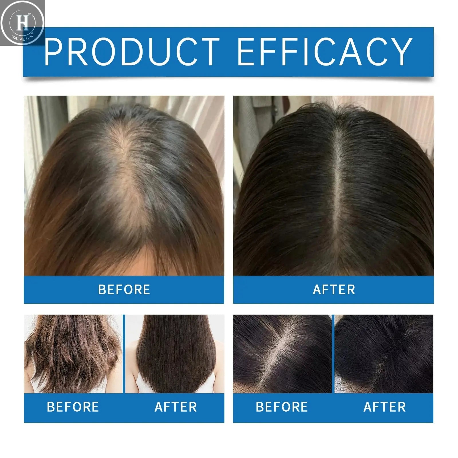 Rosemary Scalp Care Hair Growth Serum Rollerball Nourishing Essence Thinning Hair Hair Loss Treatment for Thicker Fuller Hair HALALZEN