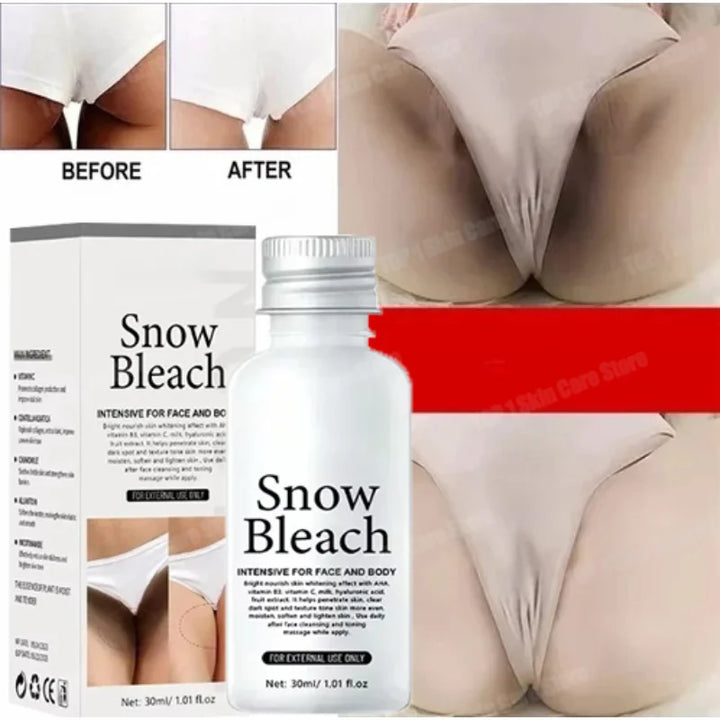 HOT~Whitening Cream Private Parts Underarm Bleaching Serum Whiten Butt Knee Brighten Inner Thigh Intimate Parts Dark Remove Mela