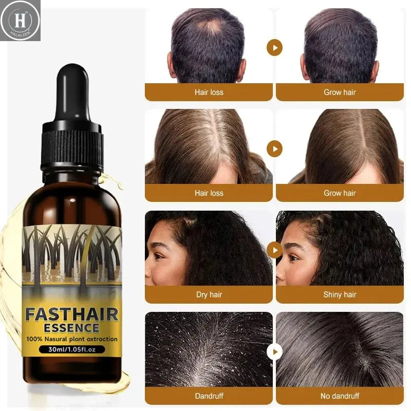 Hair growth plant essence oil beauty care anti hair loss essence natural repair damaged hair HALALZEN