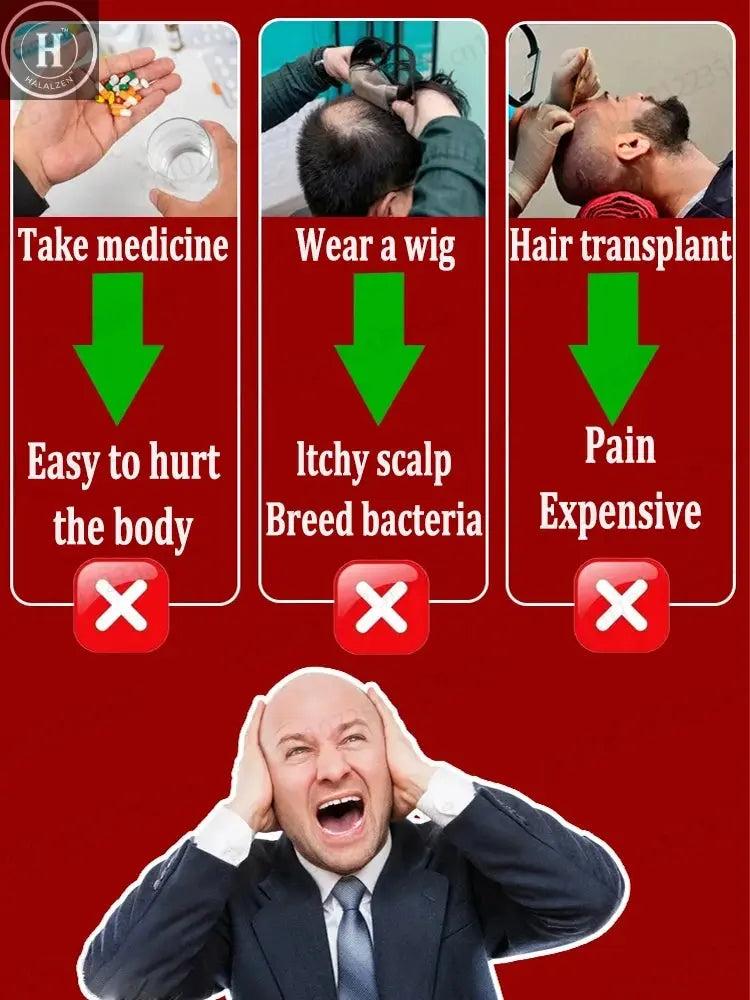 This is absolutely the most effective hair growth product of the 21st century, which has helped millions of people get rid of ha HALALZEN