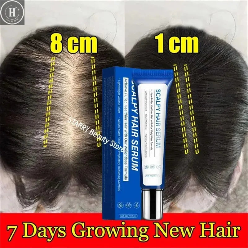 Fast Hair Growth Serum Hair Regrowth Essential Oil Anti Hair loss Repair Damaged Scalp Women Men Anti Baldness Hair Growth Care HALALZEN