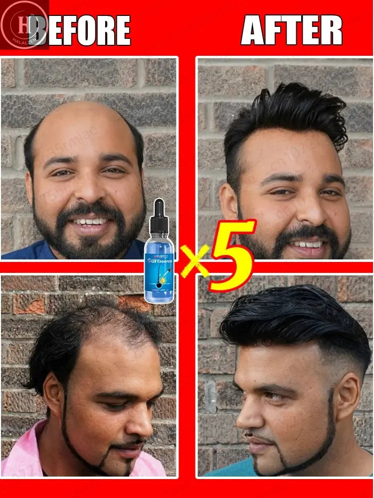 This is absolutely the most effective hair growth product of the 21st century, which has helped millions of people get rid of ha HALALZEN