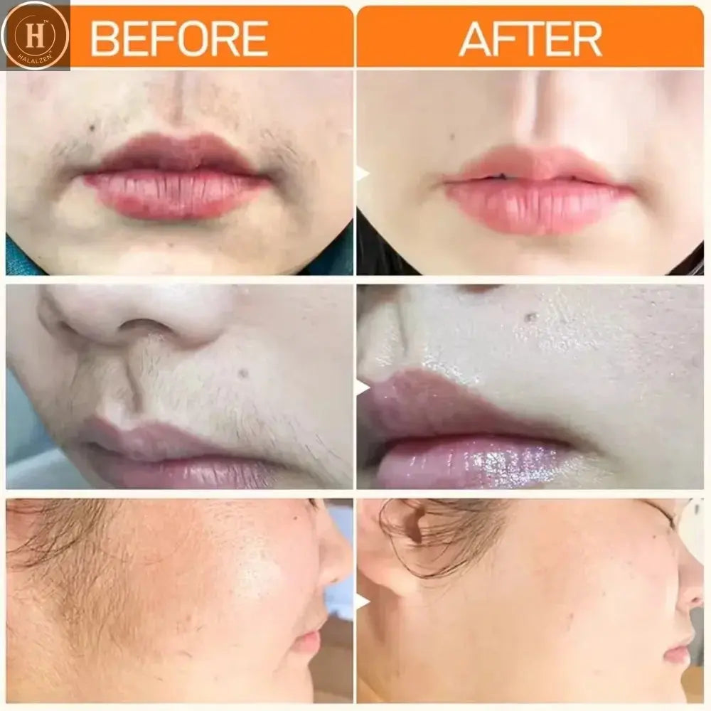 3 Minutes Fast Hair Removal Cream Painless Hair Growth Inhibitor Lip Face Arm Armpit Leg Permanent Depilatory for Men Women Care HALALZEN