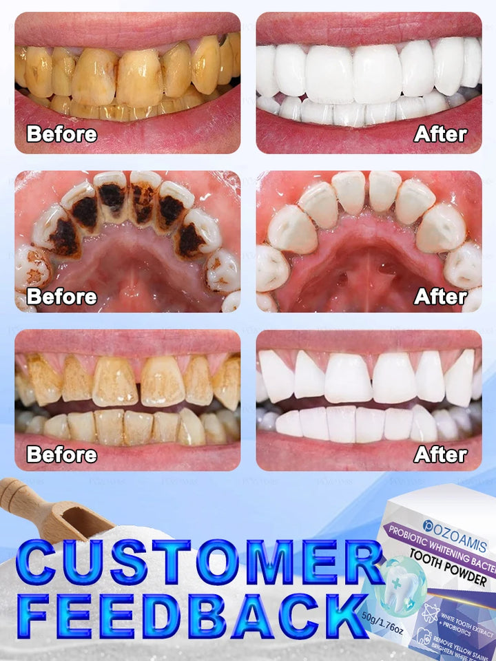 2025 New Technology Effectively Whitens Teeth and Cleansing Plaque Mineral Powder