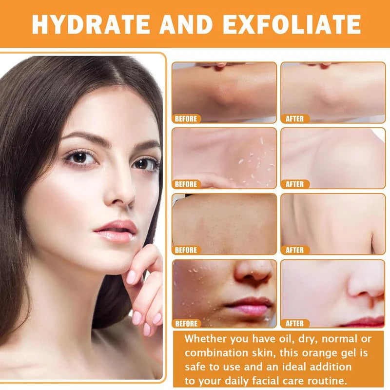 Orange Exfoliating Gel – 100g