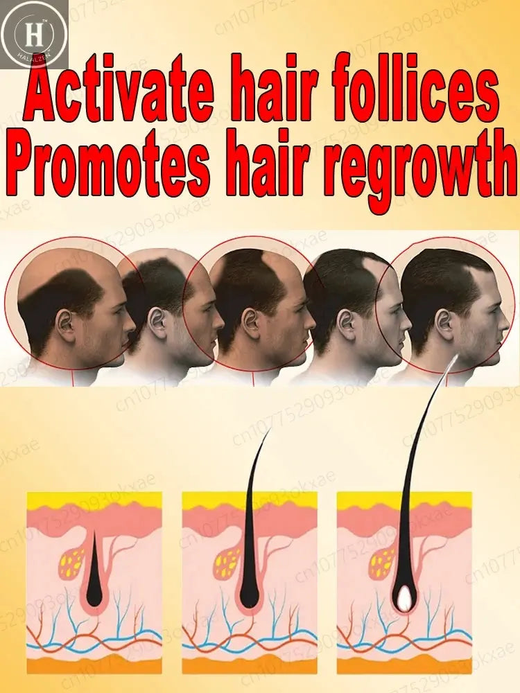 This is absolutely the most effective hair growth product of the 21st century, which has helped millions of people get rid of ha HALALZEN