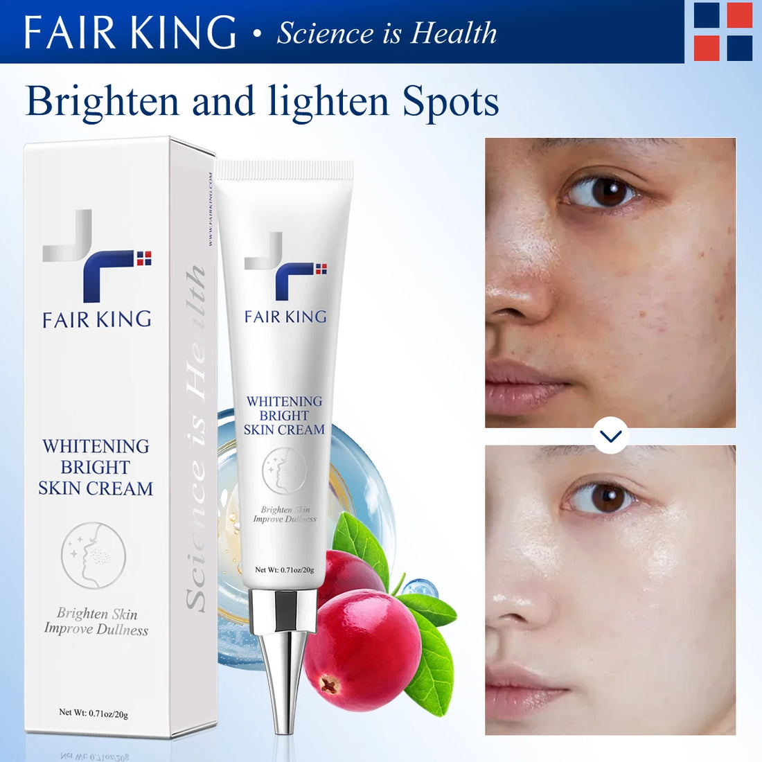 FAIRKING Spot Cream Remove Chloasma Eliminate Dark Spots Brighten Skin Tone Face Skin Care Products Improves Dull Skin