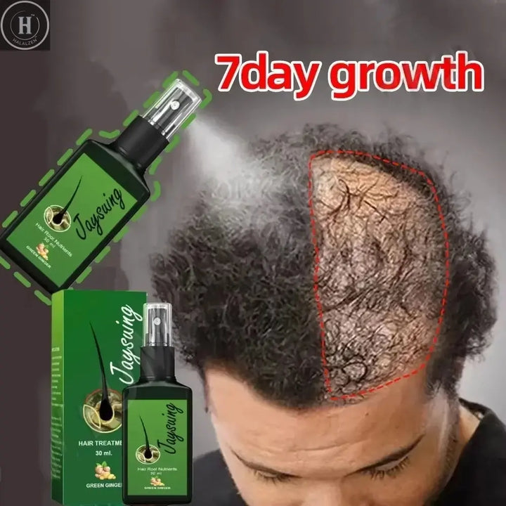 Fast Hair Growth Serum Spray Anti Hair Loss Prevent Baldness Scalp Treatment Repair Roots Beauty Health Hair Care For Men Women HALALZEN