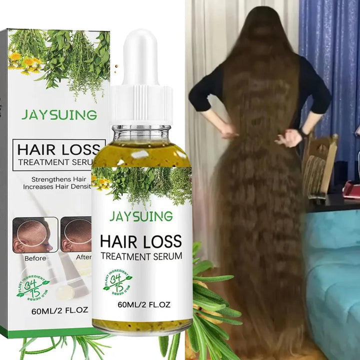 Rosemary Oil For Hair Rosemary Scalp Hair Oil, All Type & Texture | Straight, Waves & Chemically Hairs Strengthens HALALZEN