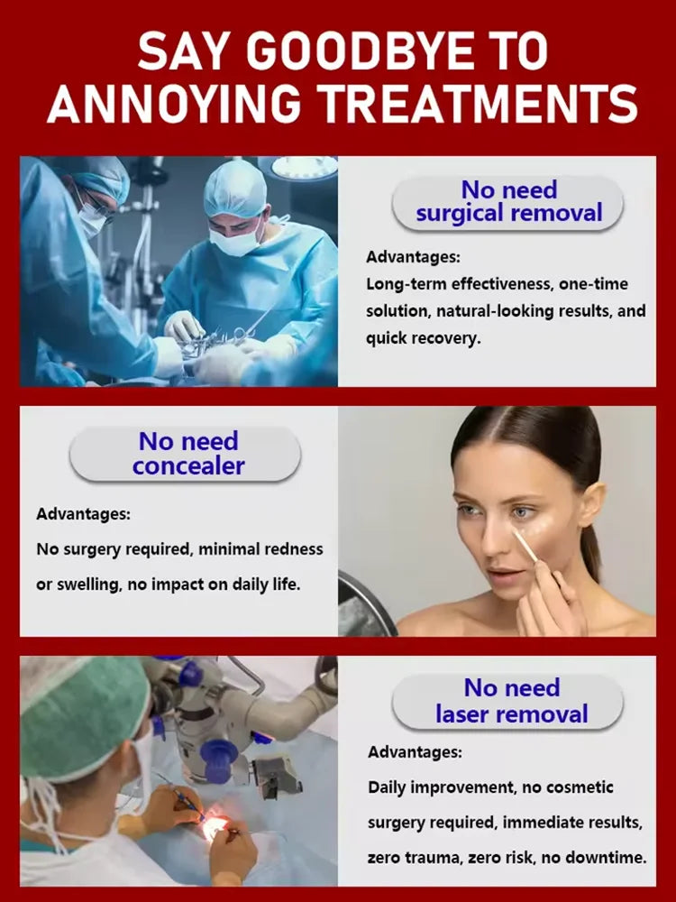 Make your eye area skin betterᑫᵘⁱᶜᵏˡʸ ʳᵉᵐᵒᵛᵉˢ ᵉʸᵉ ᵇᵃᵍˢ ᵃⁿᵈ ᵖʳᵒᵗᵉᶜᵗˢ ᵗʰᵉ ᵉʸᵉ ᵃʳᵉᵃ