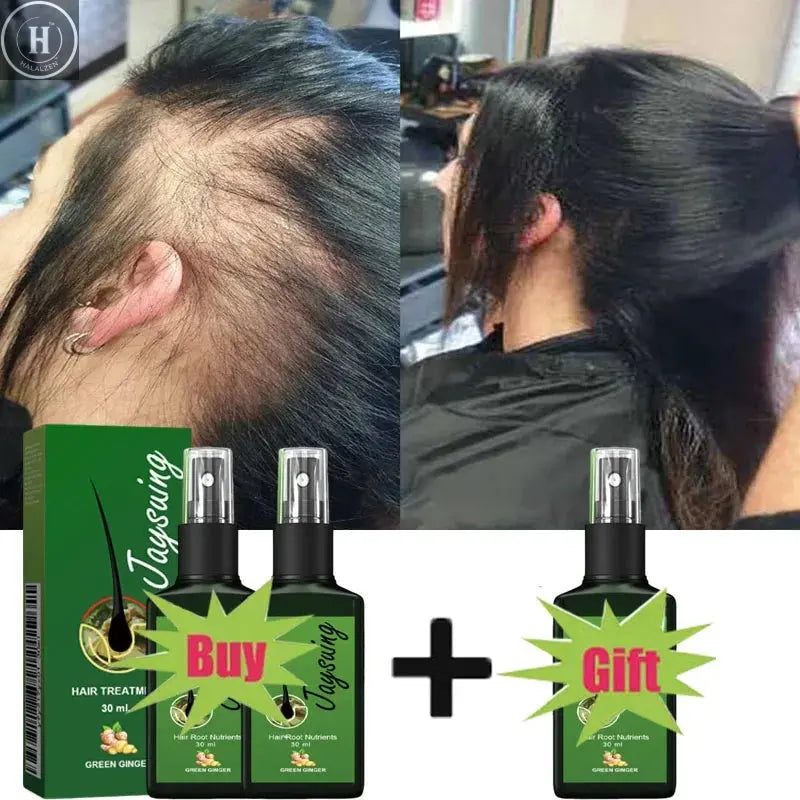 Fast Hair Growth Serum Spray Anti Hair Loss Prevent Baldness Scalp Treatment Repair Roots Beauty Health Hair Care For Men Women HALALZEN