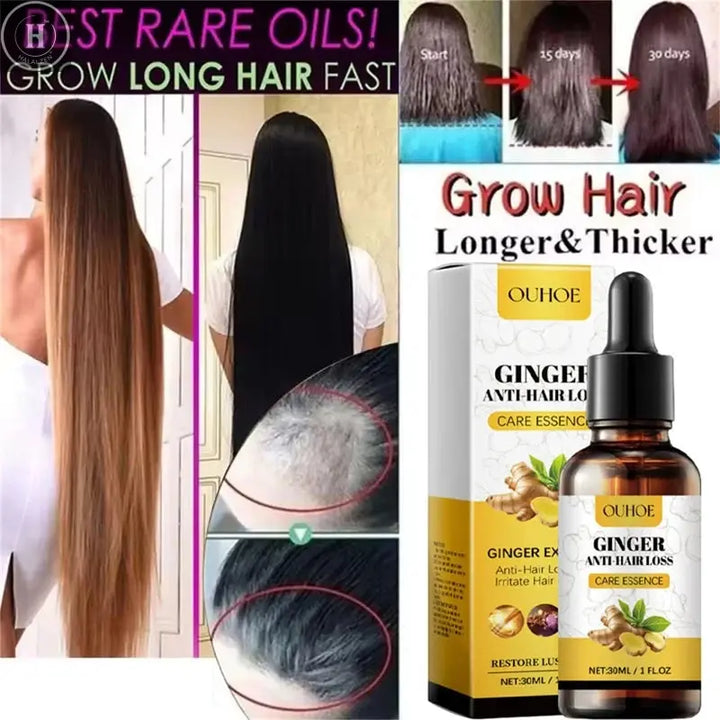 Ginger Hair Growth Essential Oil Anti-loss Hair Treatment Hair Regrowth Oil Fast Hair Promoting Regeneration Hair Care Women Men HALALZEN