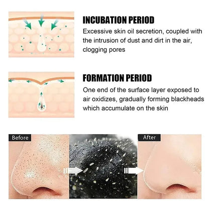 Blackhead Remover Nose Strips Pore Cleansing Skin Care Patches