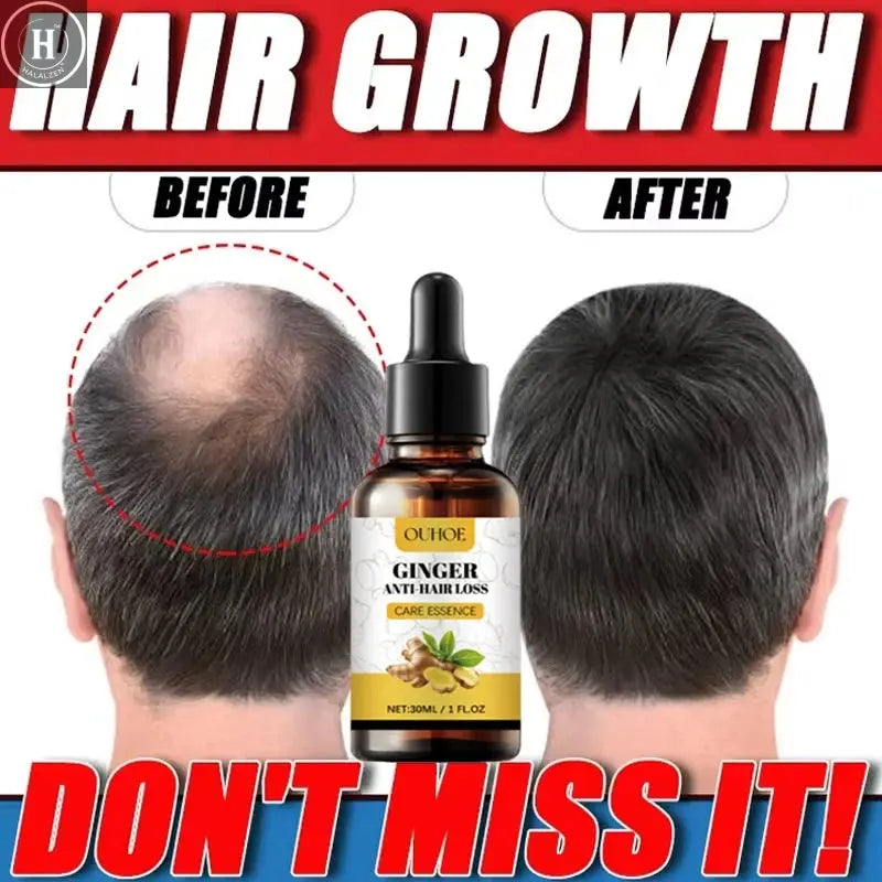Ginger Hair Growth Essential Oil Anti-loss Hair Treatment Hair Regrowth Oil Fast Hair Promoting Regeneration Hair Care Women Men HALALZEN