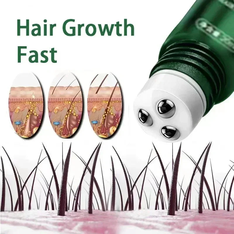 Hair Growth Oil Rapid Growth, Hereditary & Postpartum Loss Solution, Seborrheic Relief, Hair Repair Products with Ball Bearings