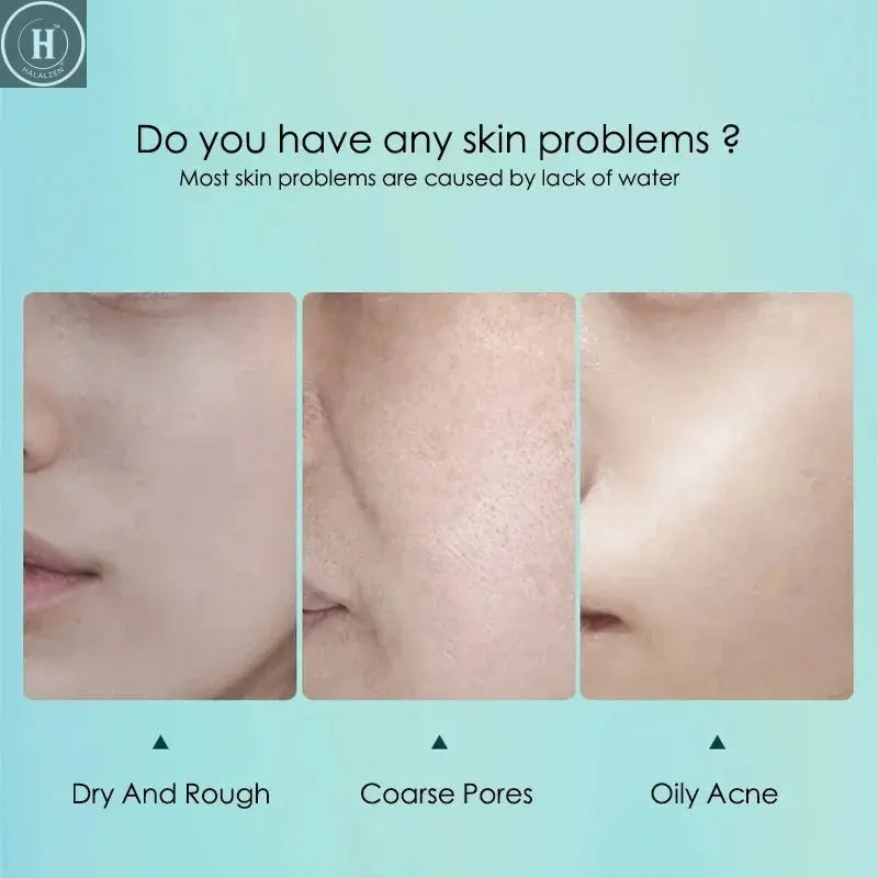 10pcs Hyaluronic Acid Hydrating Facial Mask Sheet Masks for Face Hydrating Shrinking Pores Moisturizing Face Masks Skin Care HALALZEN