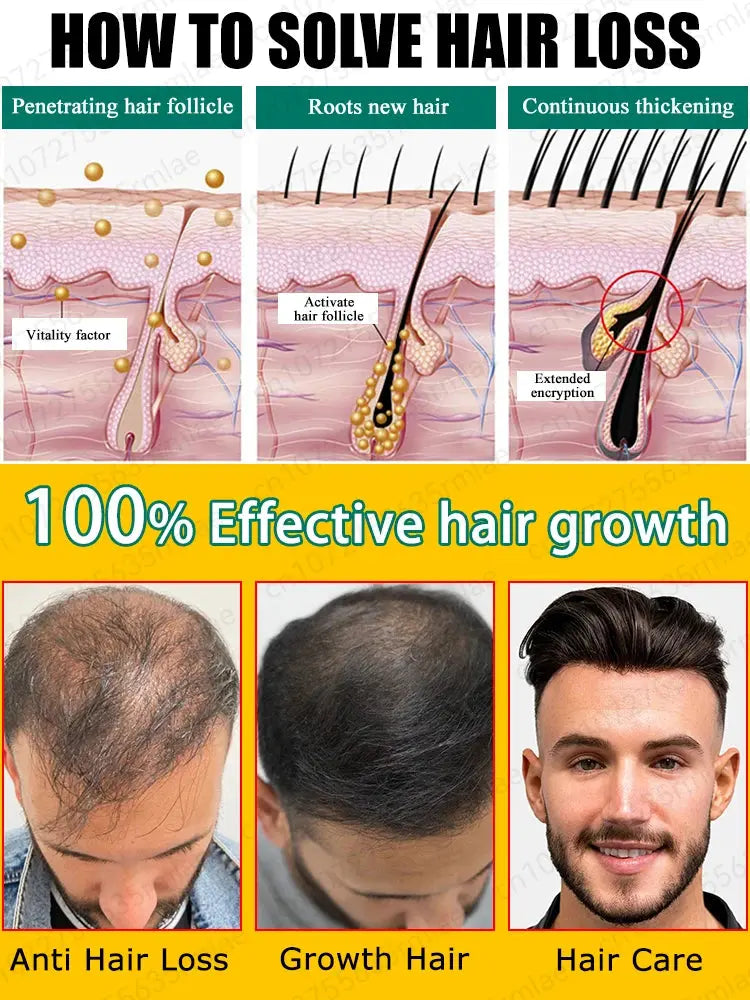 Grow cool hair secretly and surprise everyone. Say goodbye to baldness and hair loss now HALALZEN