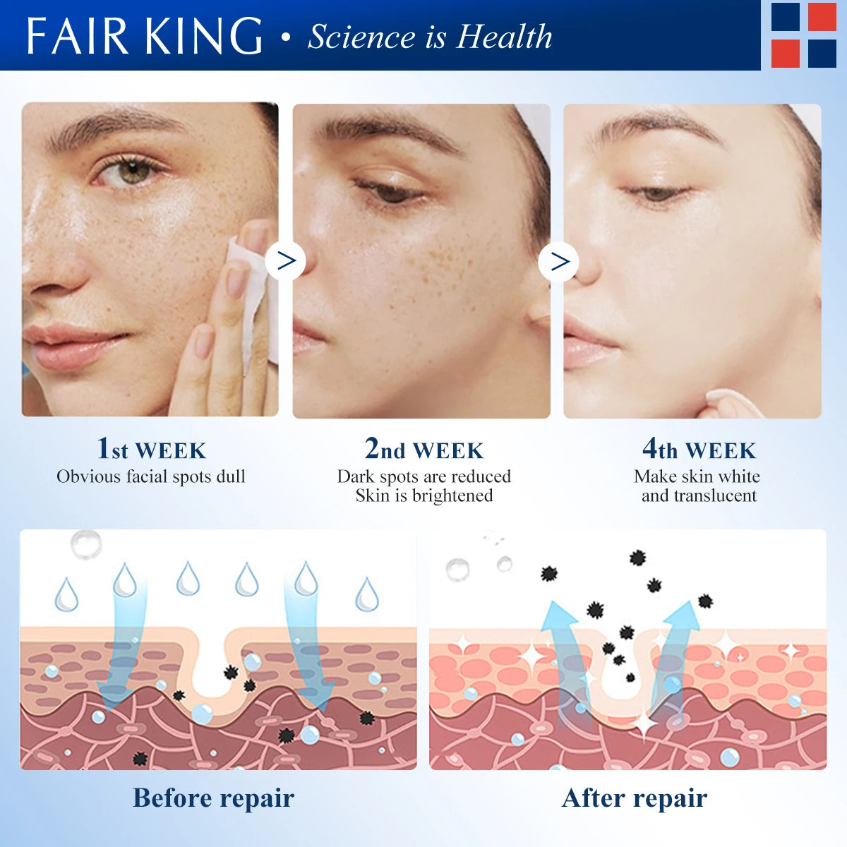 FAIRKING Spot Cream Remove Chloasma Eliminate Dark Spots Brighten Skin Tone Face Skin Care Products Improves Dull Skin