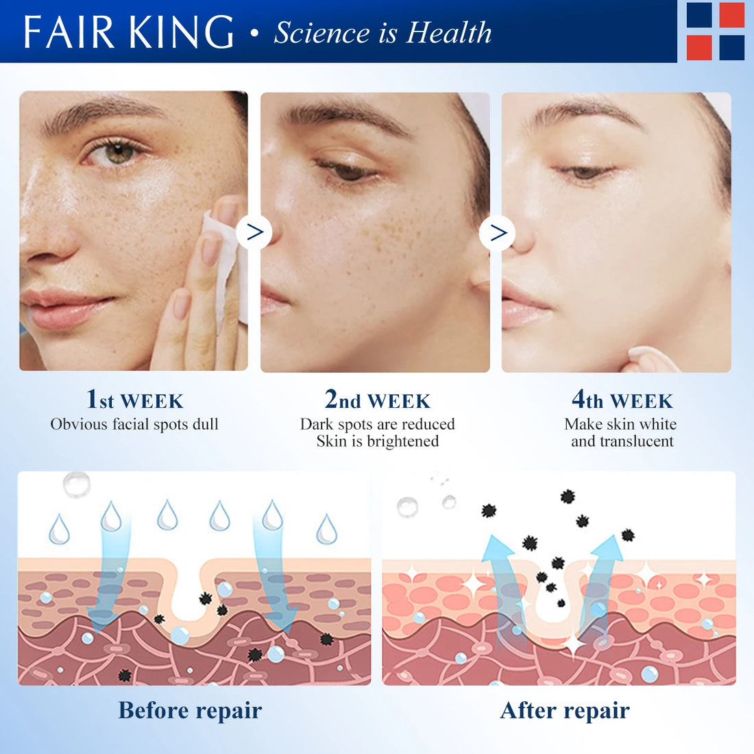 FAIRKING Spot Cream Remove Chloasma Eliminate Dark Spots Brighten Skin Tone Face Skin Care Products Improves Dull Skin