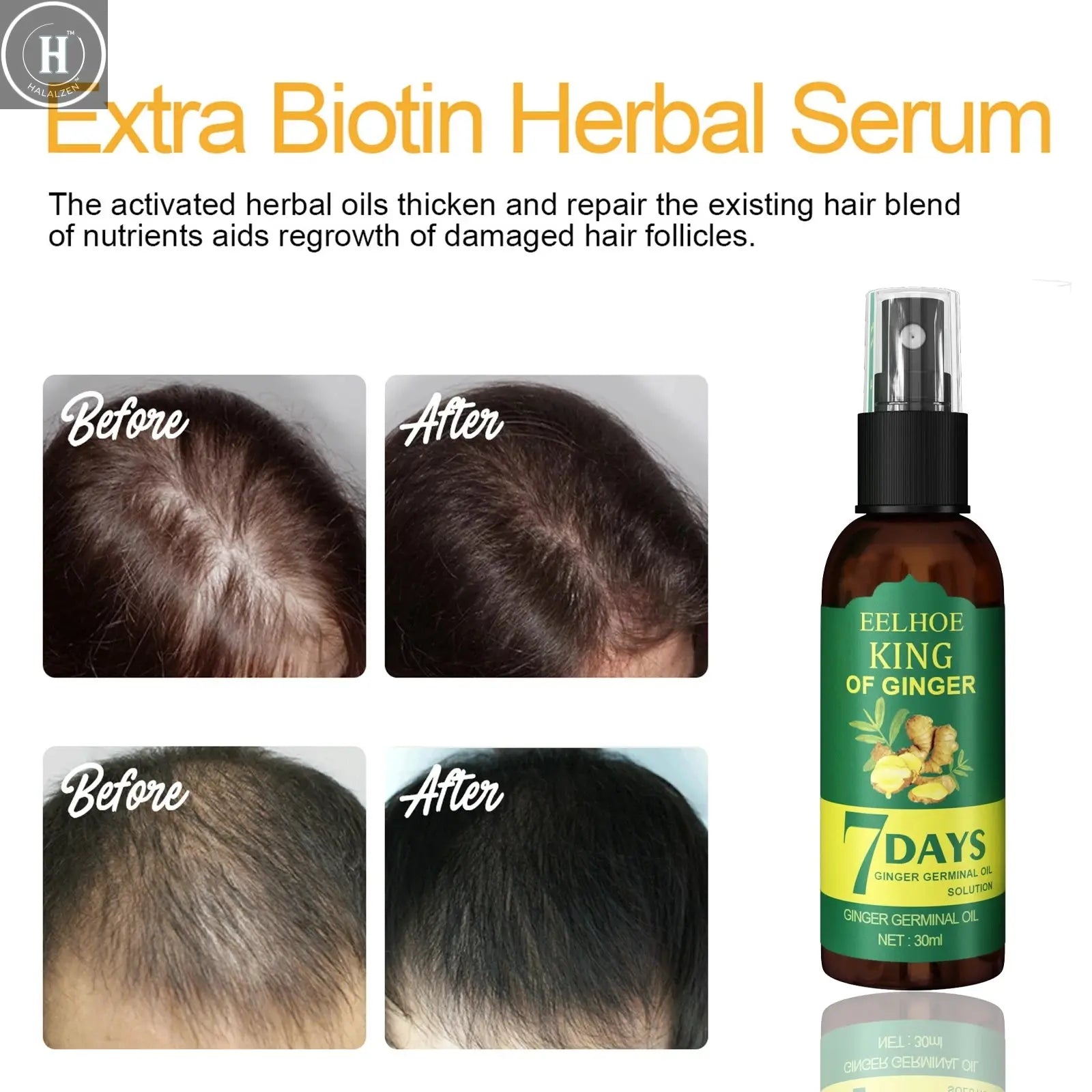 Ginger Oil Hair Booster Serum Spray Nourish Scalp Hair Follicles Refresh Control Oil Strengthen Hair Roots Nutrient Solution HALALZEN