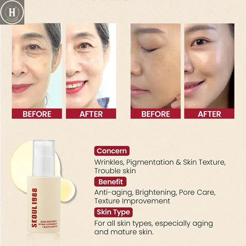 1/2/3PCS Korean SEOUL 1988 Retinol Face Serum Fade Fine Wrinkle Moisturizing Whitening Remove Spot Shrink Pores Beauty Skin Care HALALZEN
