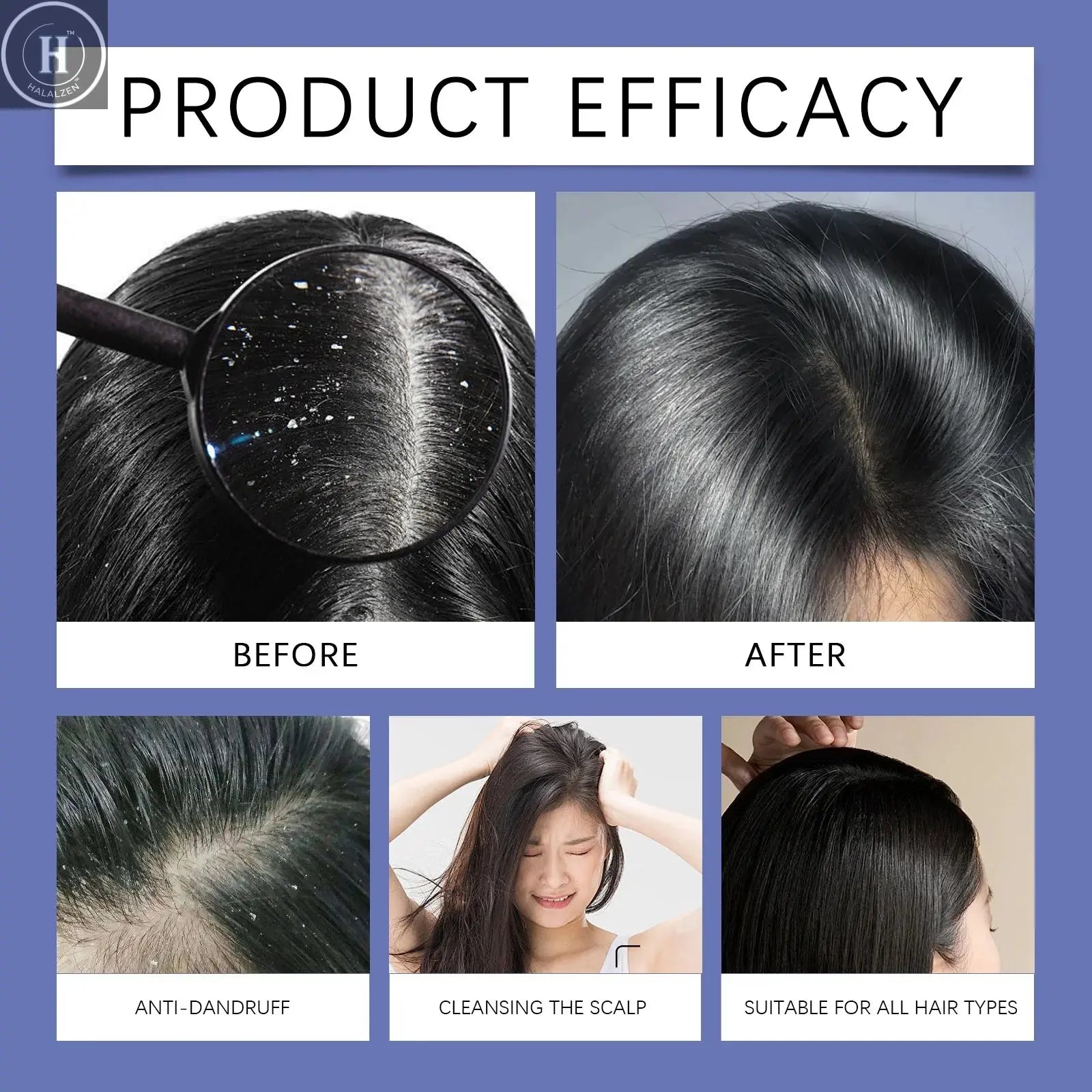 120ml Selenium Sulfide Shampoo Deep Cleansing Remove Dandruff Itchy Balance Oil Nourishing Restoration Hair Color Shampoo HALALZEN