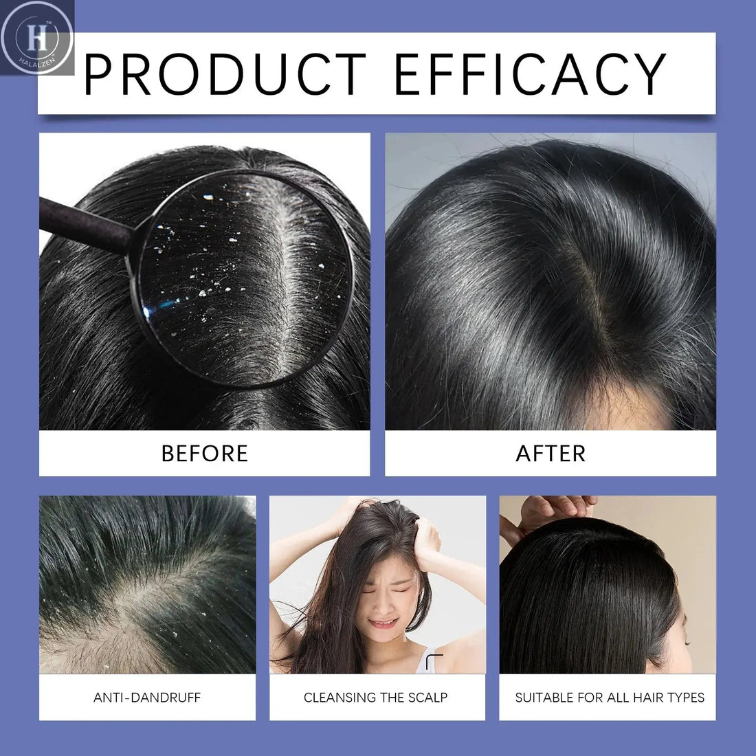 120ml Selenium Sulfide Shampoo Deep Cleansing Remove Dandruff Itchy Balance Oil Nourishing Restoration Hair Color Shampoo HALALZEN