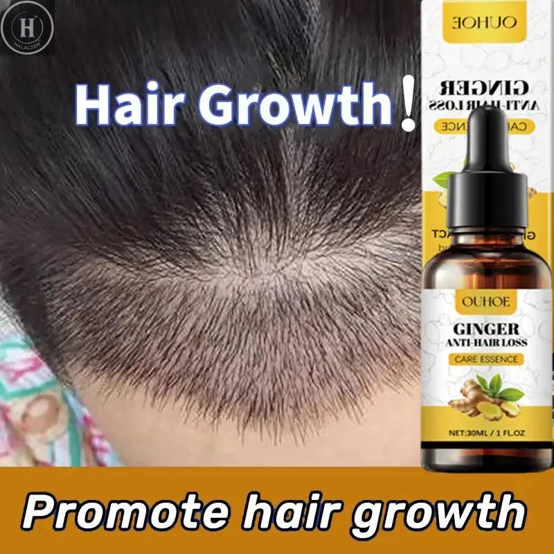 Ginger Hair Growth Essential Oil Anti-loss Hair Treatment Hair Regrowth Oil Fast Hair Promoting Regeneration Hair Care Women Men HALALZEN