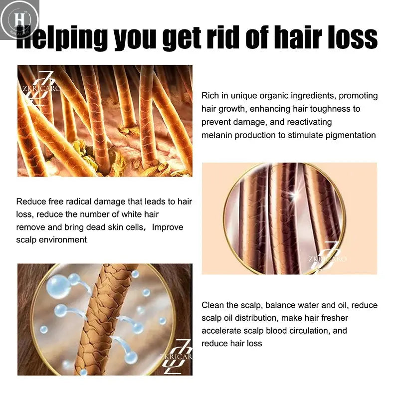 Promote hair root growth and give you beautiful hair HALALZEN