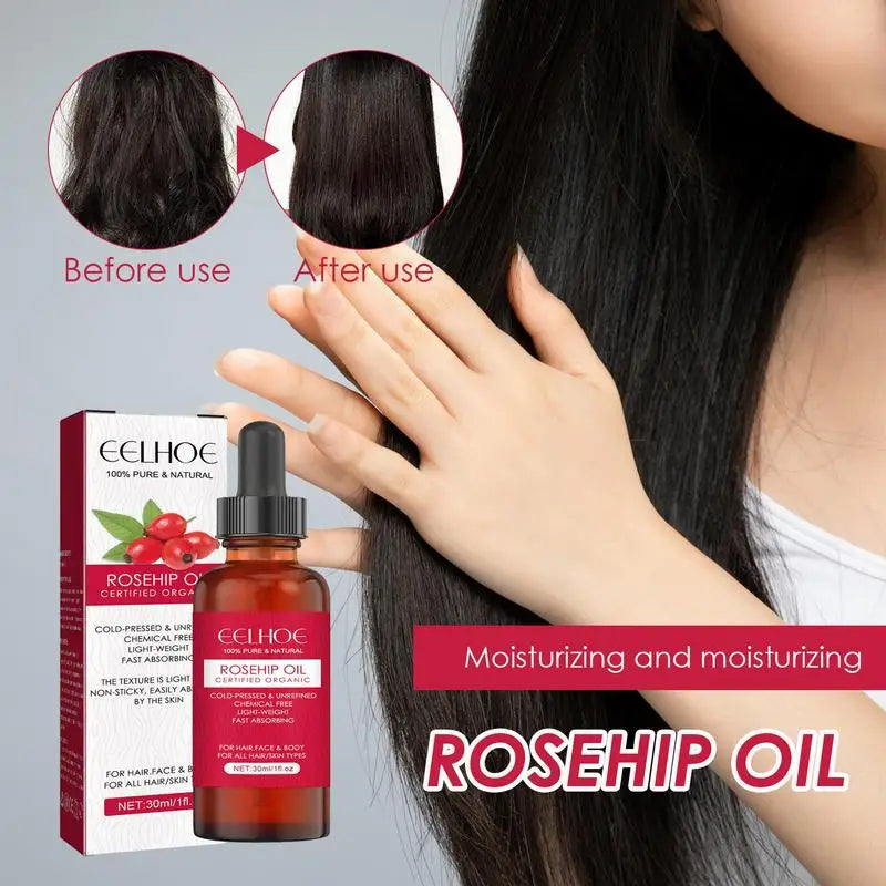 Rosehip Oil for Face & Skin Organic Rosehip Seed Oil for Gua Sha Massage Pure Cold Pressed Rose Hip Oil for Acne Scars HALALZEN
