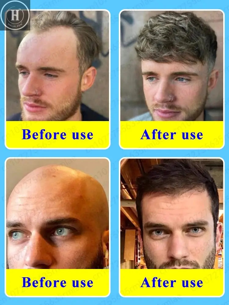 It helps the growth of hair, beard and chest hair. You can see new hair growing the next day. It is very effective. HALALZEN