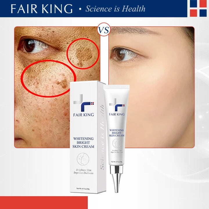 FAIRKING Spot Cream Remove Chloasma Eliminate Dark Spots Brighten Skin Tone Face Skin Care Products Improves Dull Skin