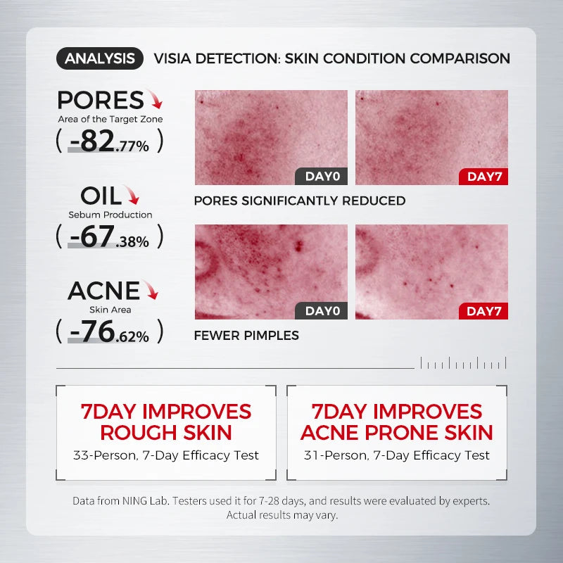 Salicylic Acid 2% Face Serum: Niacinamide, Centella Extract, BHA + PHA, Blemish Soothing, Pore Refining & Oil Regulation HALALZEN