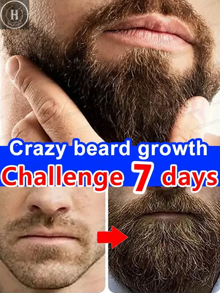 The most effective beard growth essence in 2025, grow a thick beard in 7 days. Chest hair, leg hair, beard and hair growth HALALZEN